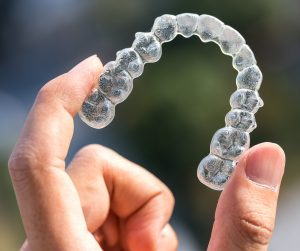 invisalign clear braces in Alexandria VA