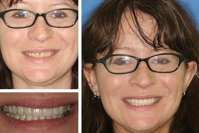 A Mt. Vernon patient smiling after cosmetic dental treatment.