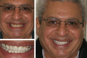 Alexandria patient before and after photos with Dr. Geren