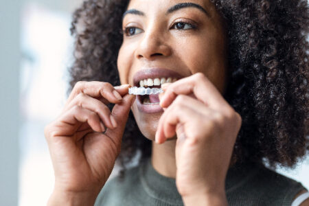 Transform Your Smile: The Invisalign Experience in Alexandria